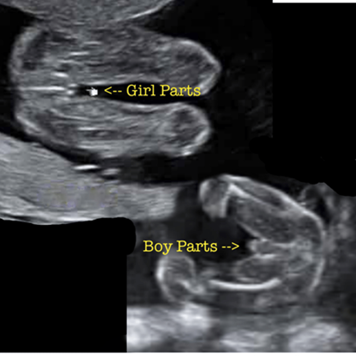 <p>- The baby's sex depends on the father's sperm.</p>