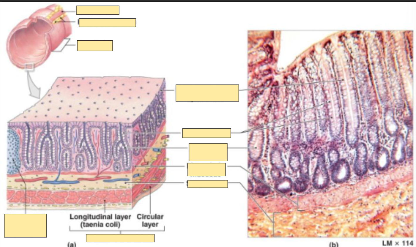 <p>cells making up the large intestine</p>