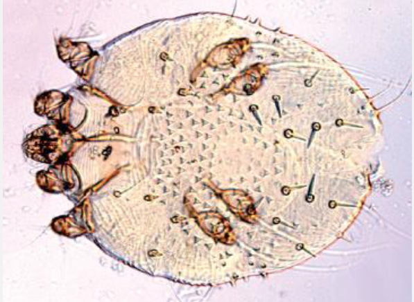 <p><em>Sarcoptes</em>: morphological features</p>