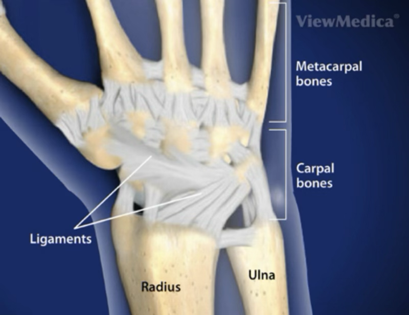 <p>wrist sprain</p>
