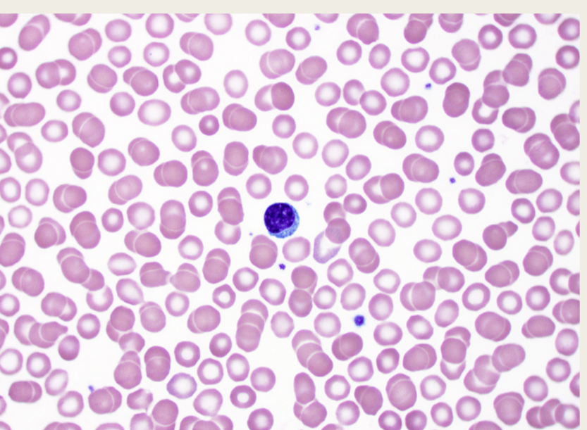 <p>What is this image of?</p>