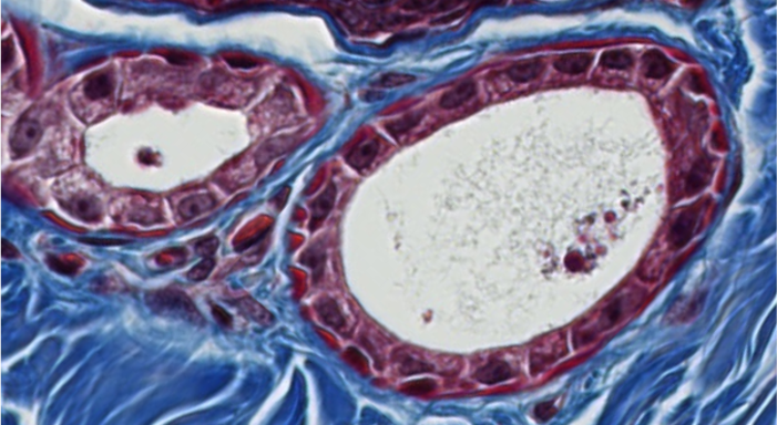 <p><span style="font-family: "Calibri Light";">Which type of epithelium is lining the luminal surface of these two structures?</span></p>