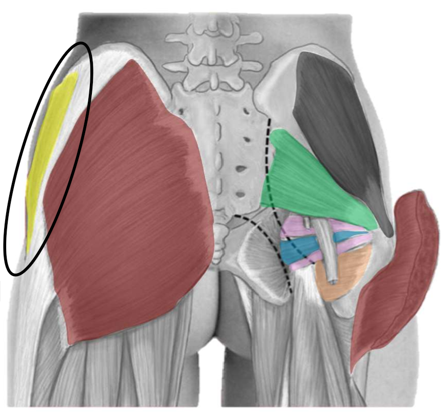 term image