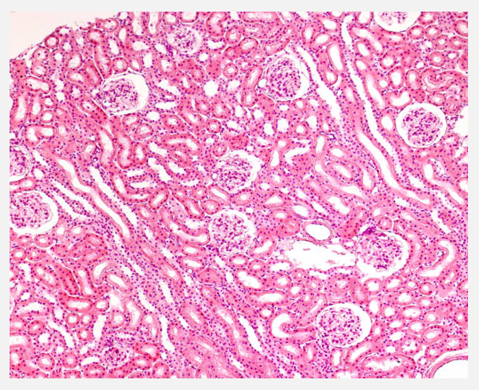 <p>Kidney histology (pt 2)</p>