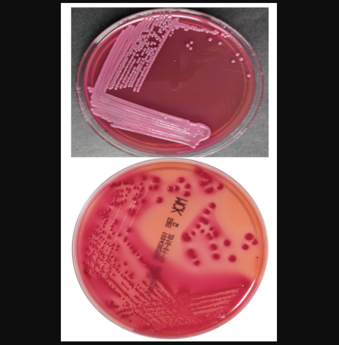 <p>macconkey agar</p>