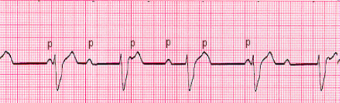 <p>what waveform is this</p>