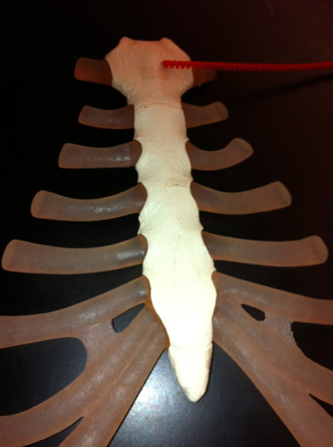 <p>What part of the sternum is this?</p>