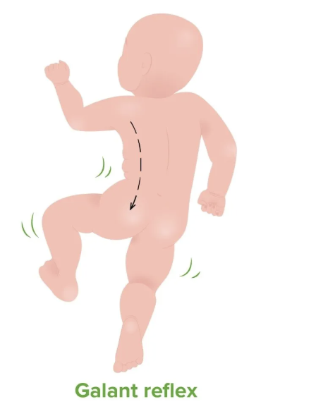 <p>elicited by holding the newborn face down (prone) and stroking 1 side of the spine; baby’s trunk laterally flexes towards the stimulated side</p><ul><li><p>important for facilitating (1) lateral trunk movements/trunk stabilization, (2) hip movement, and (3) ROM in preparation for crawling and walking</p></li></ul><ul><li><p>birth-3 months</p><ul><li><p>onset: 32 weeks gestation</p></li><li><p>integration: 2 months</p></li></ul></li><li><p>mnemonic: </p><ul><li><p>going to a “gala” and “posing”</p></li><li><p>ga”L”ant (L pose when the trunk “L”aterally flexes)</p></li></ul></li></ul><p></p>