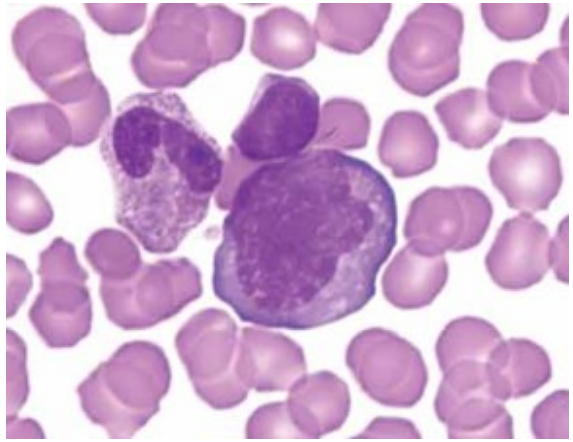 <p>what is an immunoblast?</p>