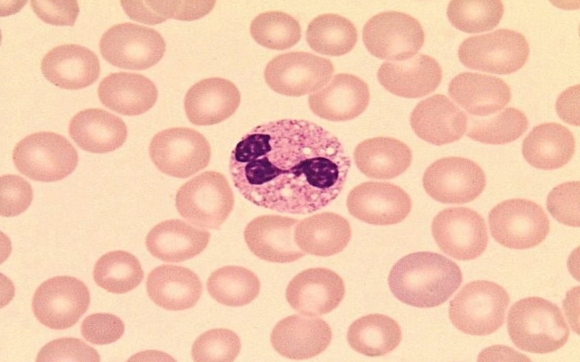 <p>what are cytoplasmic vacuoles?</p>