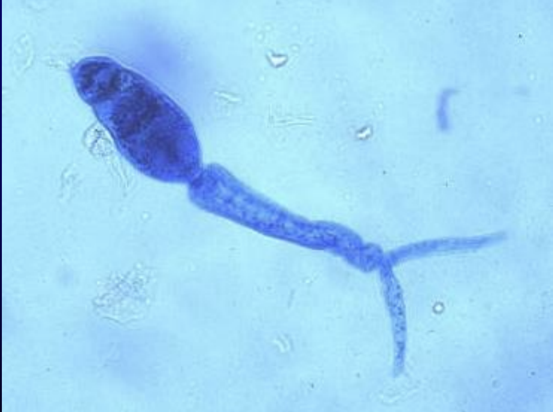 <p>What is the developmental stage of this parasite? </p>