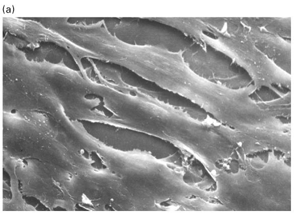 <p>is this a normal or transformed cell?</p>