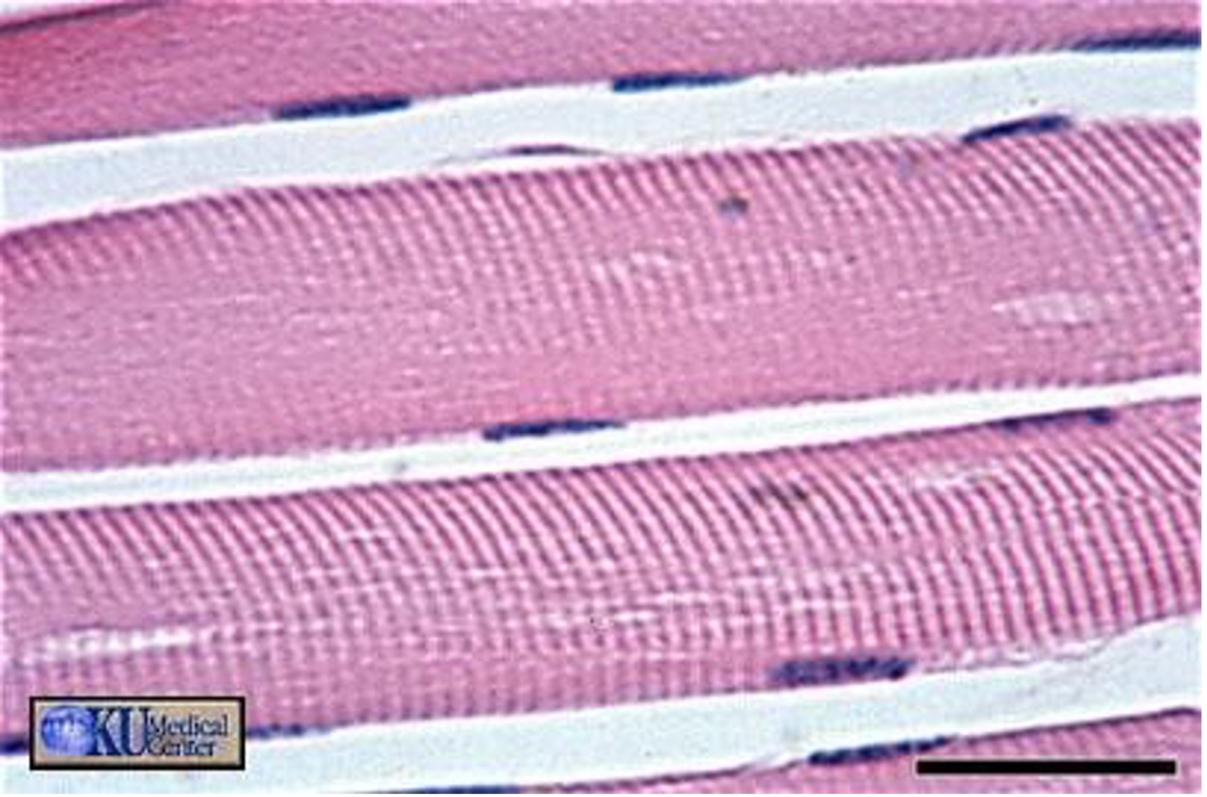<p>What muscle tissue is this?</p>