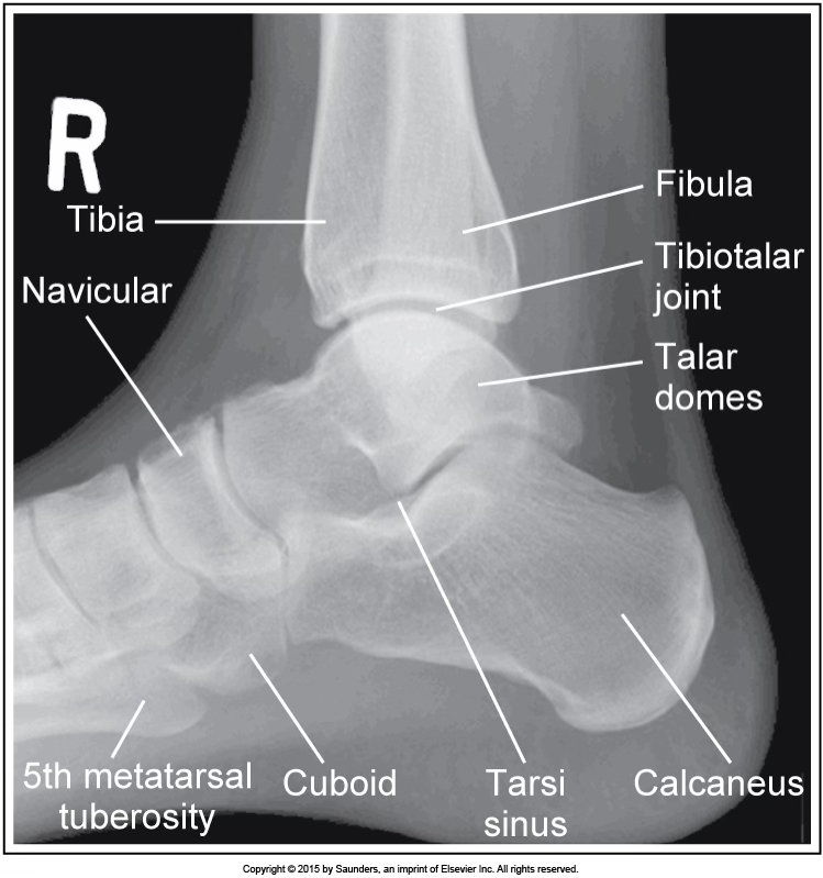 <p>lateral ankle</p>