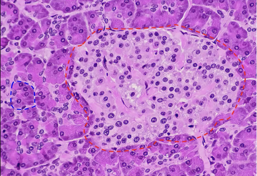 <p>Pancreas</p><p>Blue: Pancreatic acini (majority of the cells are acini, dark purple) - they make various digestive enzymes such as amylase, protease, lipase, and nuclease</p><p>Red: Pancreatic islets (1% are are these cells, the light purple) - control sugar, make insulin and glucagon</p>