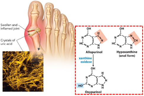 <p>Caused by a defect in purine degradation</p><p>Uric acid crystals buildup in joints &amp; kidneys</p><p>Treated with avoidance of purine-rich foods (seafood, liver)</p><p>Xanthine oxidase inhibitor allopurinol</p>