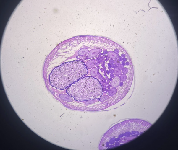 <p>What is this? What are the two balls?</p>