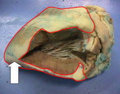 <p>Name this layer on the heart.</p>
