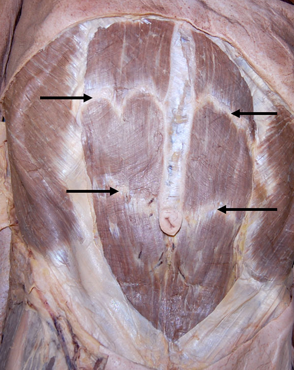 <p>Muscle?</p>