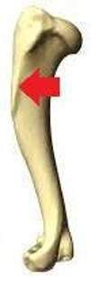 <p>Tuberosity </p>