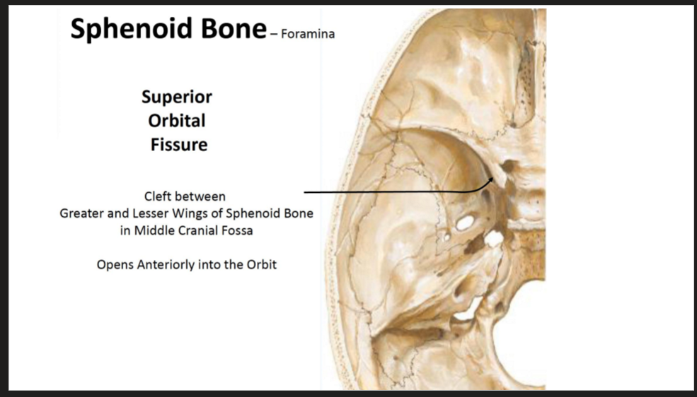 <ul><li><p>Cleft between Greater and Lesser Wings of Sphenoid Bone in Middle Cranial Fossa</p><ul><li><p>Opens Anteriorly into the Orbit</p></li></ul></li></ul><p></p>