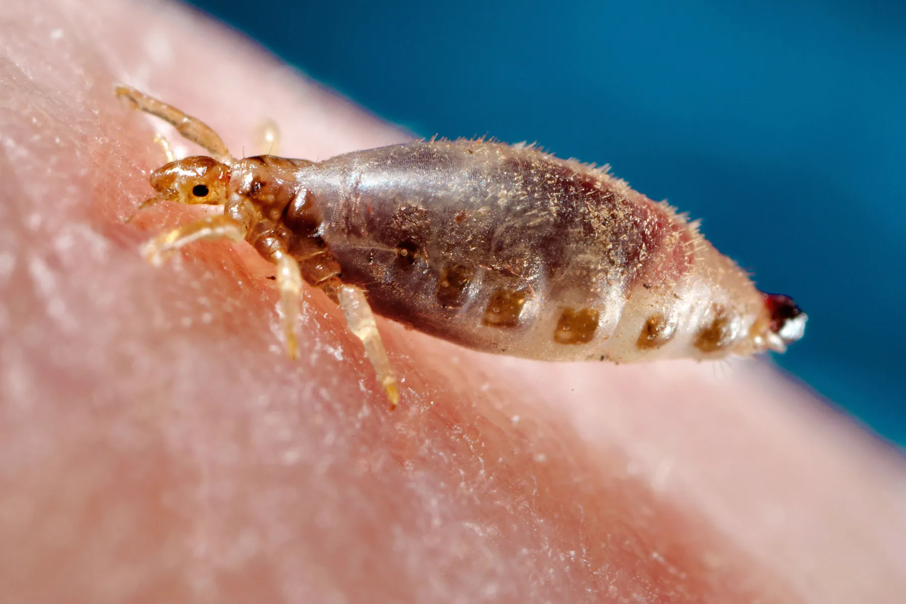 <p>Phthiraotera (lice)</p>