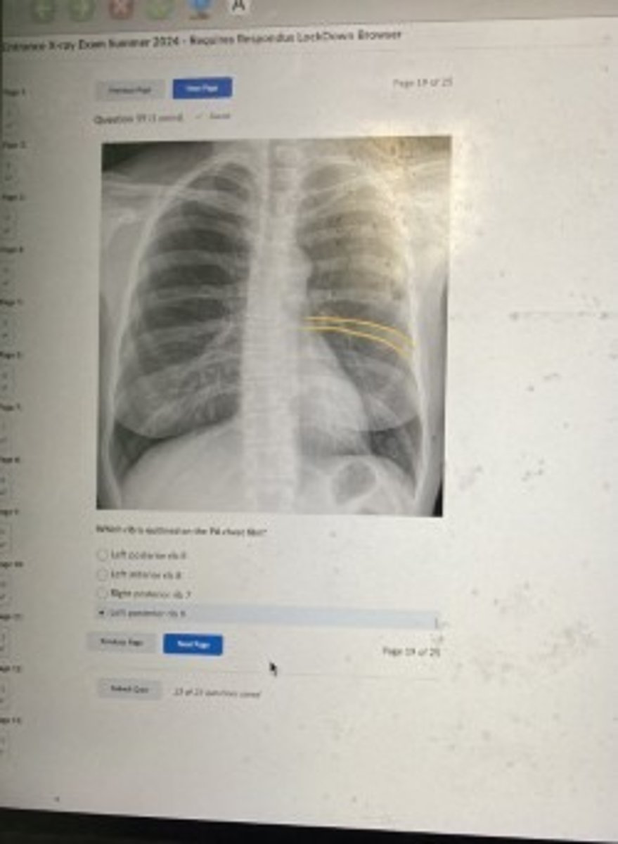<p>Left posterior rib 9</p>