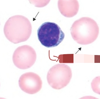 <p>Macrocyte</p>