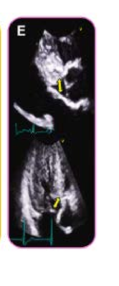 <p>what does this image show </p>