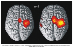 <p>Task specific produced longer lasting changes, better recovery and brain organization</p>