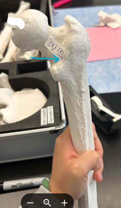 <p>ID femur/os coxae region </p>