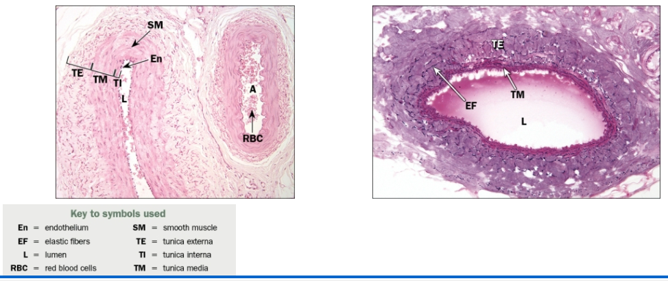 <p>Medium veins—less than 1 cm in diameter</p><ul><li><p>Tunica interna = endothelium and connective tissue, no internal elastic membrane</p></li><li><p>Tunica media = smooth muscle</p></li><li><p>Tunica externa = collagen/elastic fibers</p><ul><li><p>Valves present in systemic veins working against gravity</p></li></ul></li></ul><p></p>