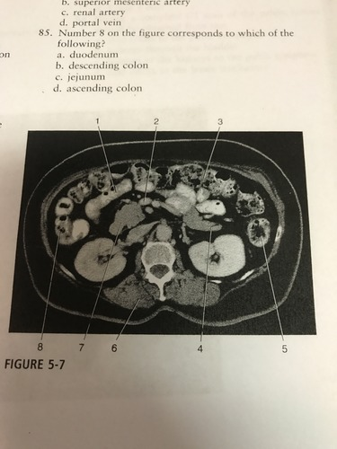 <p>Number 7 on the figure corresponds to which of the following?</p><p>A) Duodenum</p><p>B) pancreatic head</p><p>C) jejunum</p><p>D) gallbladder</p>