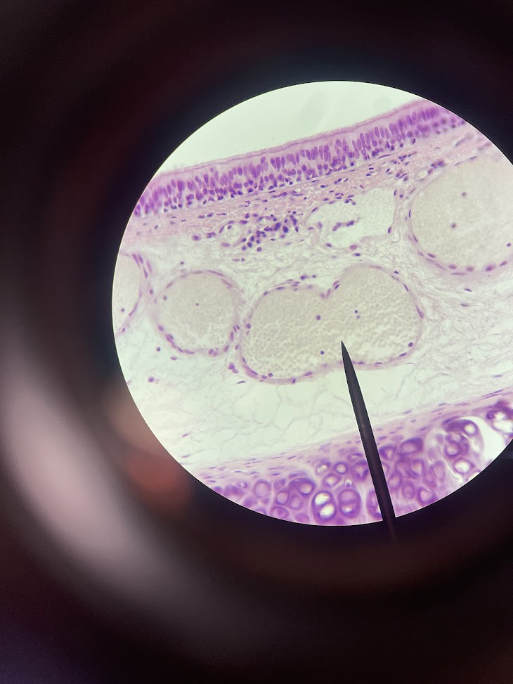 <p>tissue type surrounding the structure</p>
