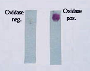 <p>Biochemische test die de aanwezigheid van cytochroom c oxidase in het MO nagaat. </p><ul><li><p>Cytochroom c oxidase speelt een belangrijke rol in de ademhalingsketen (brengt zuurstof in de cel via oxidatie van cytochroom c)</p></li><li><p>Essentieel voor aerobe bacteriën</p></li><li><p>Wanneer het reagens (tetramethyl-p-fenyleendiamine, kleurloos) wordt toegevoegd, zal deze binnen 10-20 seconden geoxideerd worden door oxidasepositieve bacteriën naar indofenolblauw, dat gekenmerkt wordt door een donkerpaarse, bijna zwarte kleur. </p></li></ul><p></p>