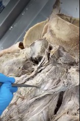 <p>Name the muscle</p><p>- most deep layer</p><p>- most medial cervicis of spinalis and semispinalis</p>