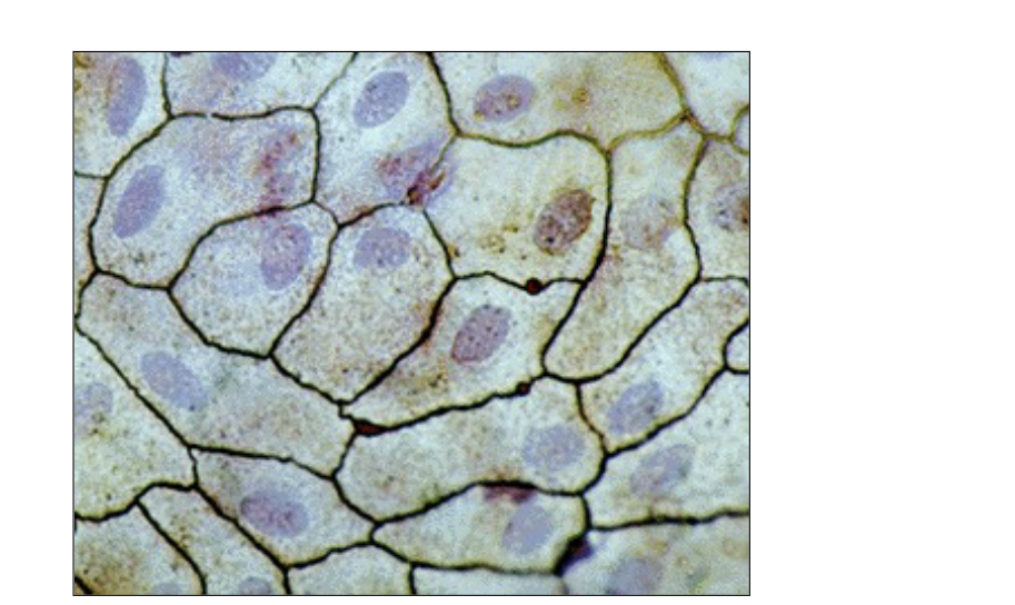 <ul><li><p>kidney glomeruli (site of filtration for blood to get made into urine) </p></li><li><p>air sacs of lungs (alveoli) = air needs to cross walls for o2 to get into bloodstream </p></li><li><p>lining inside of heart </p></li><li><p>ling of blood vessels = nutrient diffusion and gases </p></li><li><p>lymphatic vessels </p></li><li><p>lining of ventral body cavity (serosae) </p><ul><li><p>visceral and parietal layers of serous membranes (made up of this) </p></li></ul></li></ul><p></p>