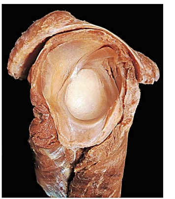 <p>Label the following:</p><ul><li><p>tendons</p></li><li><p>ligaments</p></li><li><p>joint capsule</p></li><li><p>labrum</p></li></ul><p></p>