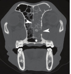 <p>What are you seeing on this CT?</p>