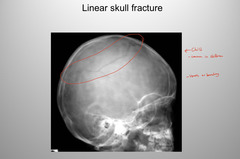 <p>Linear</p>