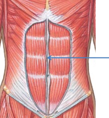 <p>band of connective tissue</p>