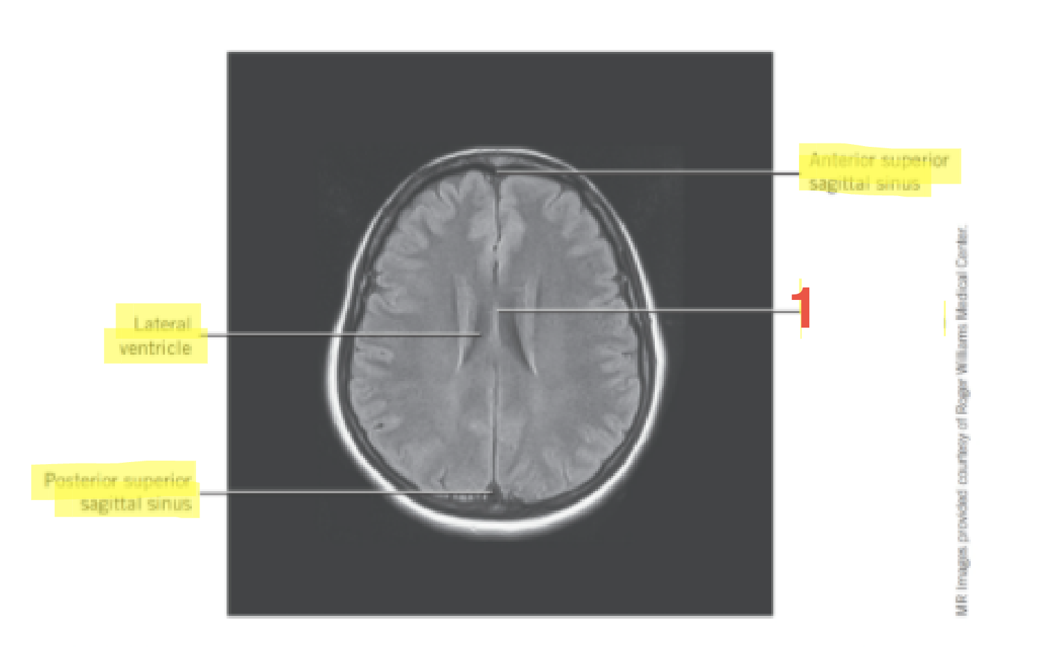 <p>1</p>