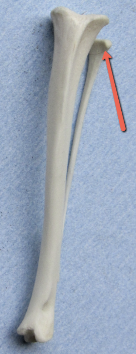 <p><strong>Identify the bone marking indicated by the pointer.</strong></p>