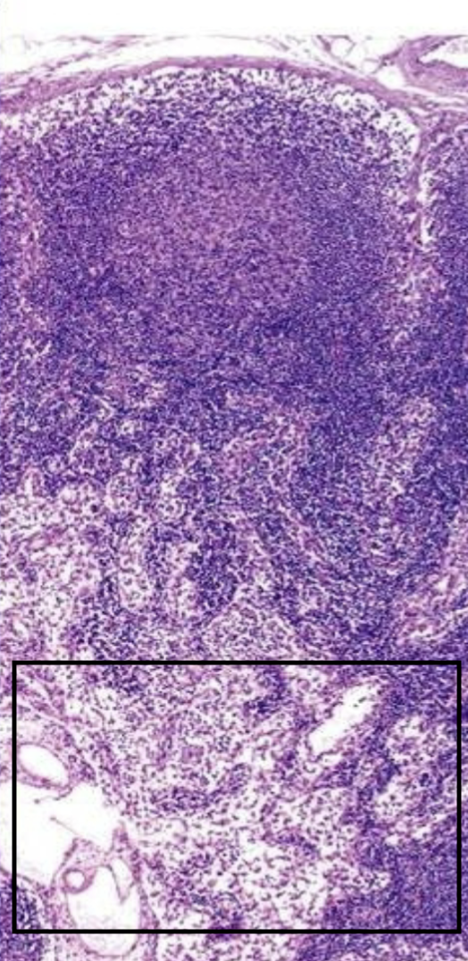 <p>What is this boxed in area of the lymph node?</p>