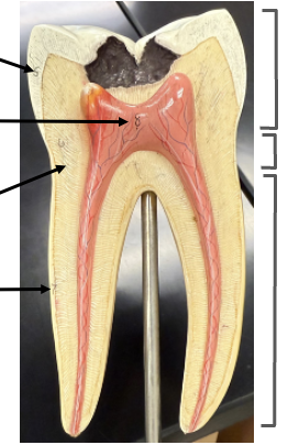<p>Pulp cavity</p><p>(and root canal containing pulp)</p>