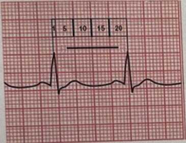 <p>which method of calculating the heart rate is shown below</p><p>a. 1-minute method</p><p>b. R-R method</p><p>c. 1500 method</p><p>d. 6-second method</p>