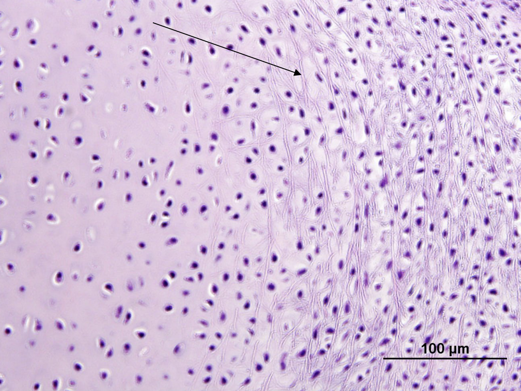 <p>what 2 types of cartilage are mixed here (hint: some fibers are refractile/glowing)?</p>
