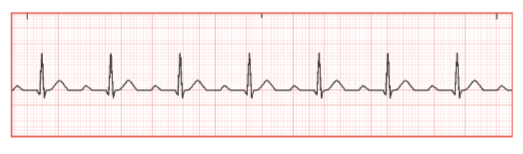 <p>Identify the heart rhythm on the ECG strip</p>