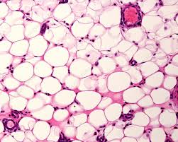 <p>which type of connective tissue is this?</p>