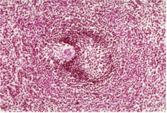 <p>What are the darker stained regions called?</p>